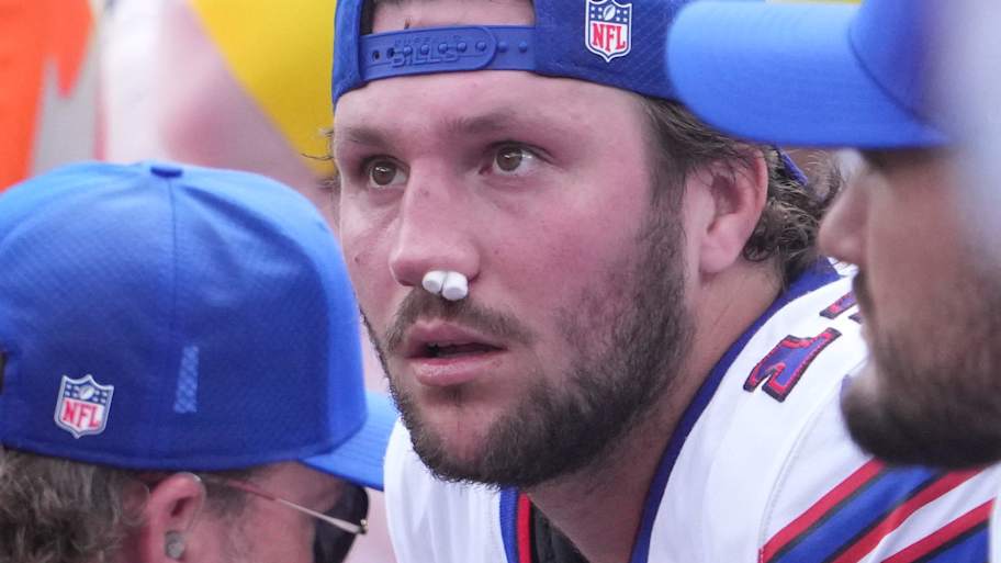 Josh Allen’s Nose Injury: Impact and Updates