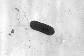 What You Need to Know About Listeria: Risks and Prevention