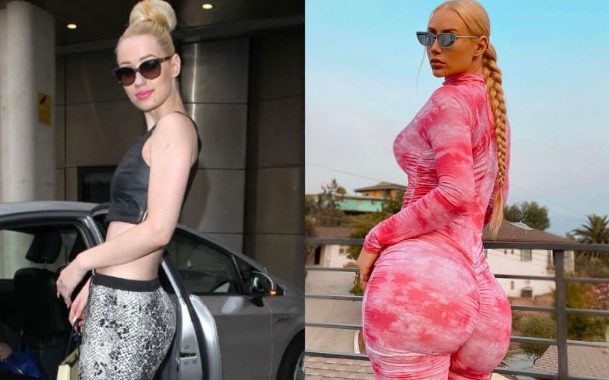 Iggy Azalea: The Evolution of a Rap Icon
