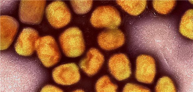 Mpox: An Overview of the Viral Infection Affecting Communities