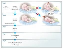 Exploring Sudden Death Syndrome: Causes and Implications