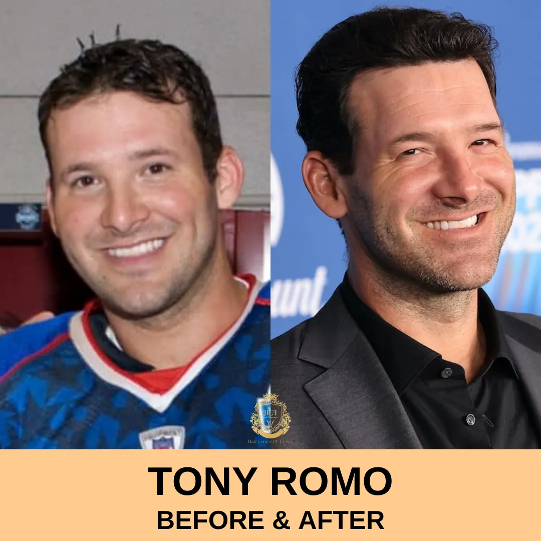 Tony Romo’s Journey from NFL Star to Broadcasting Icon