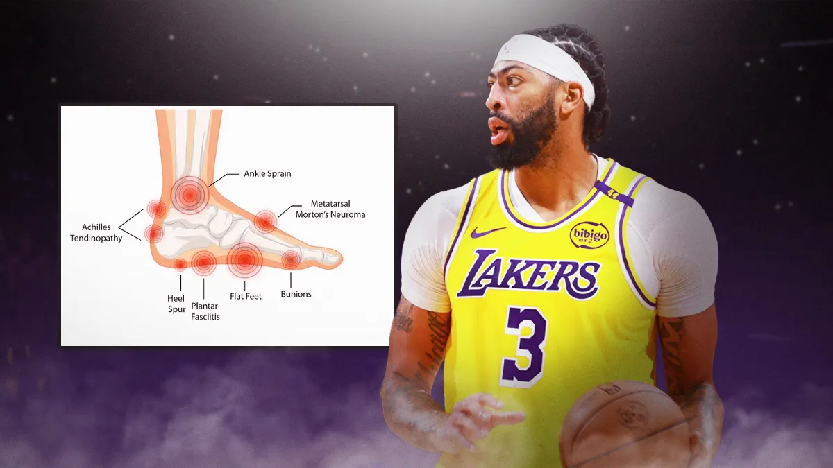 Latest News on Anthony Davis’s Injury Status