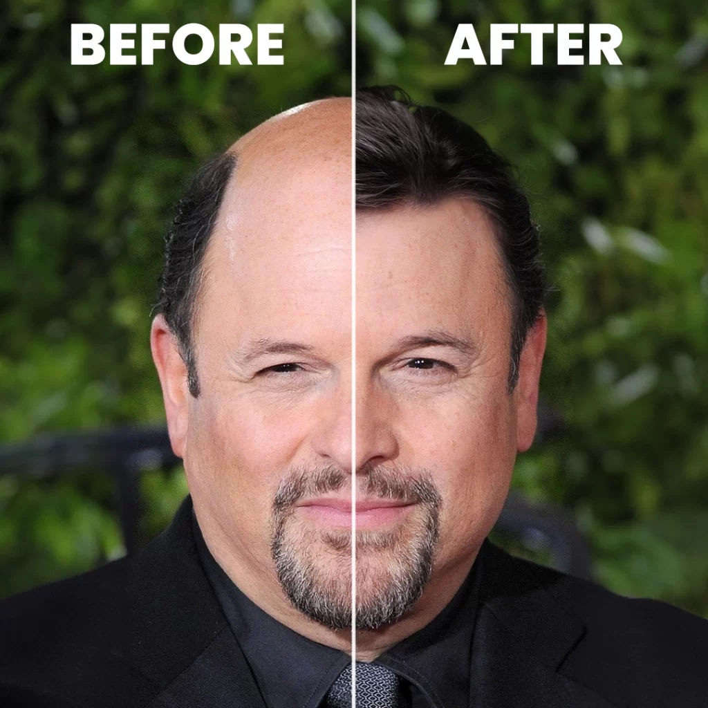 The Life and Career of Jason Alexander