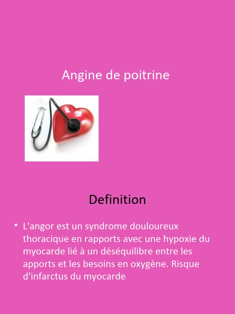 angine de poitrine tout le monde en parle — CA news